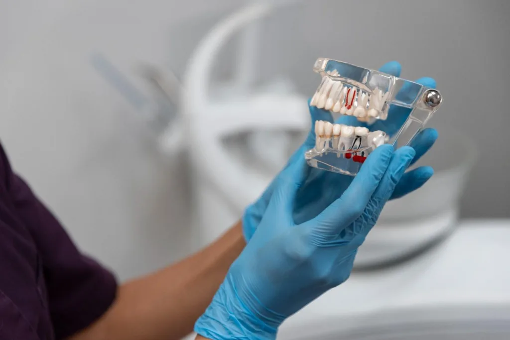 Affordable Dental Implants