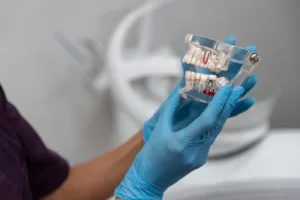 Blog Affordable Dental Implants