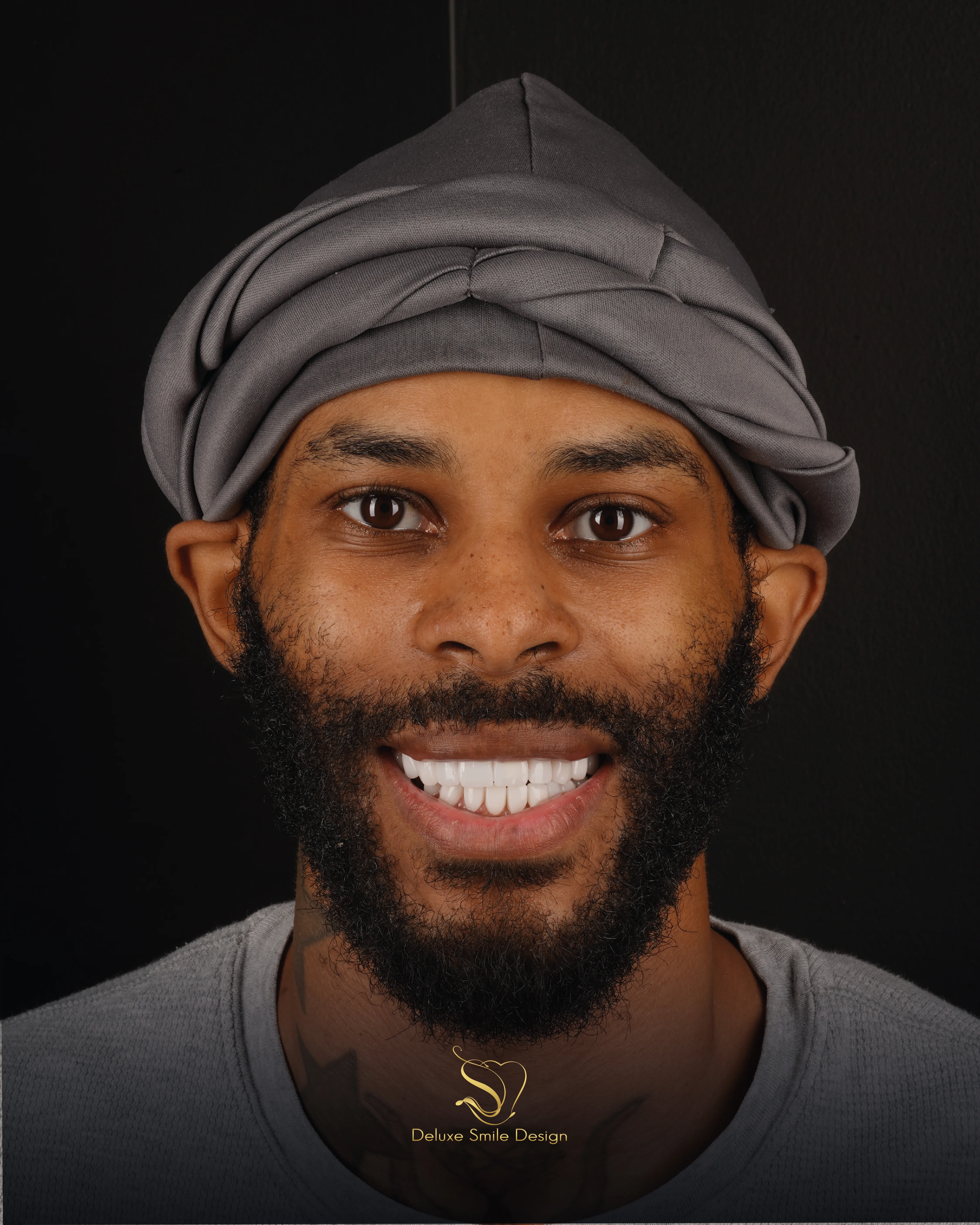 Deluxe Smile|<trp-post-container data-trp-post-id='5483'>Emergency Miami</trp-post-container>