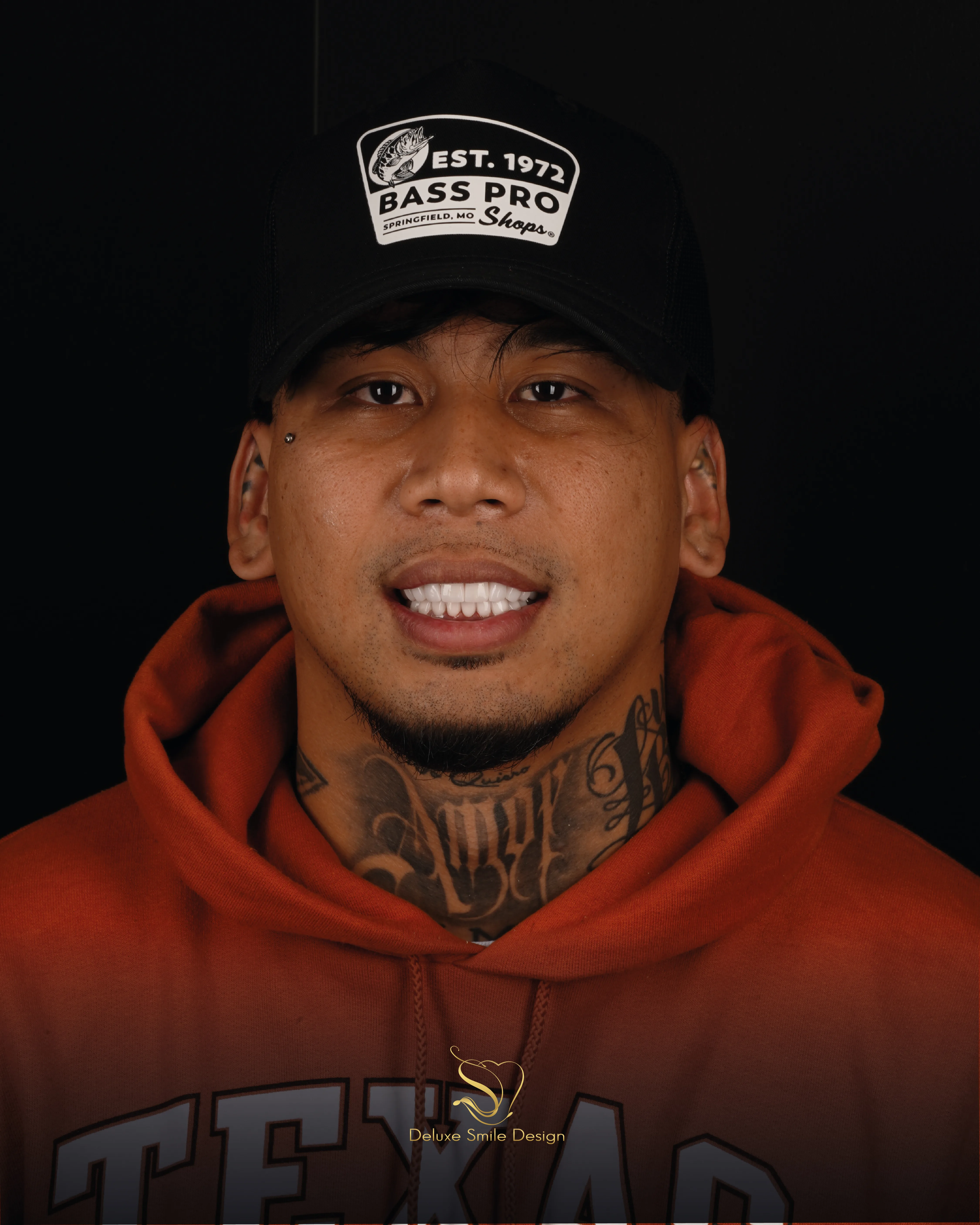 Deluxe Smile|<trp-post-container data-trp-post-id='5406'>Porcelain Veneers</trp-post-container>