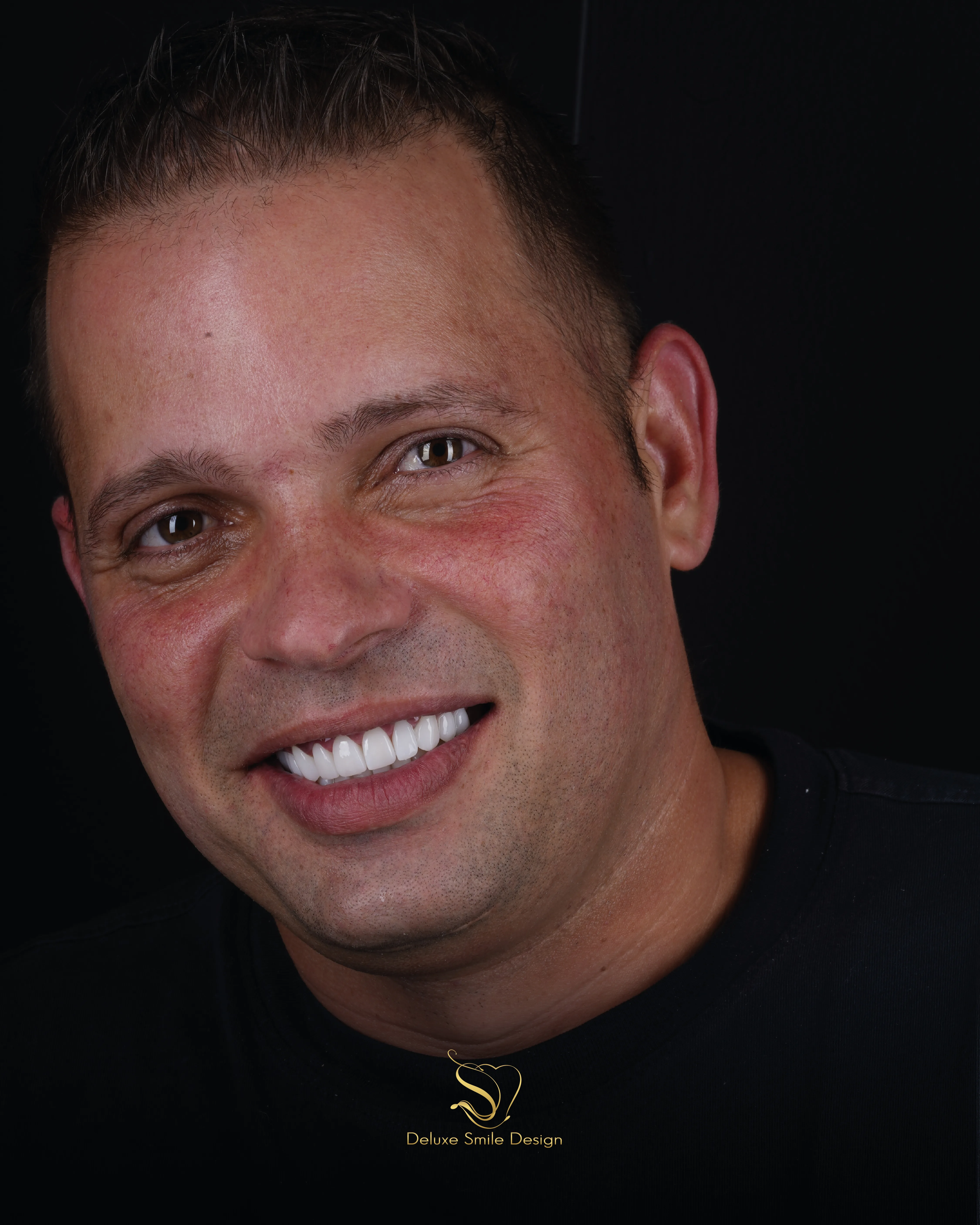 Deluxe Smile|Dental Implant Miami