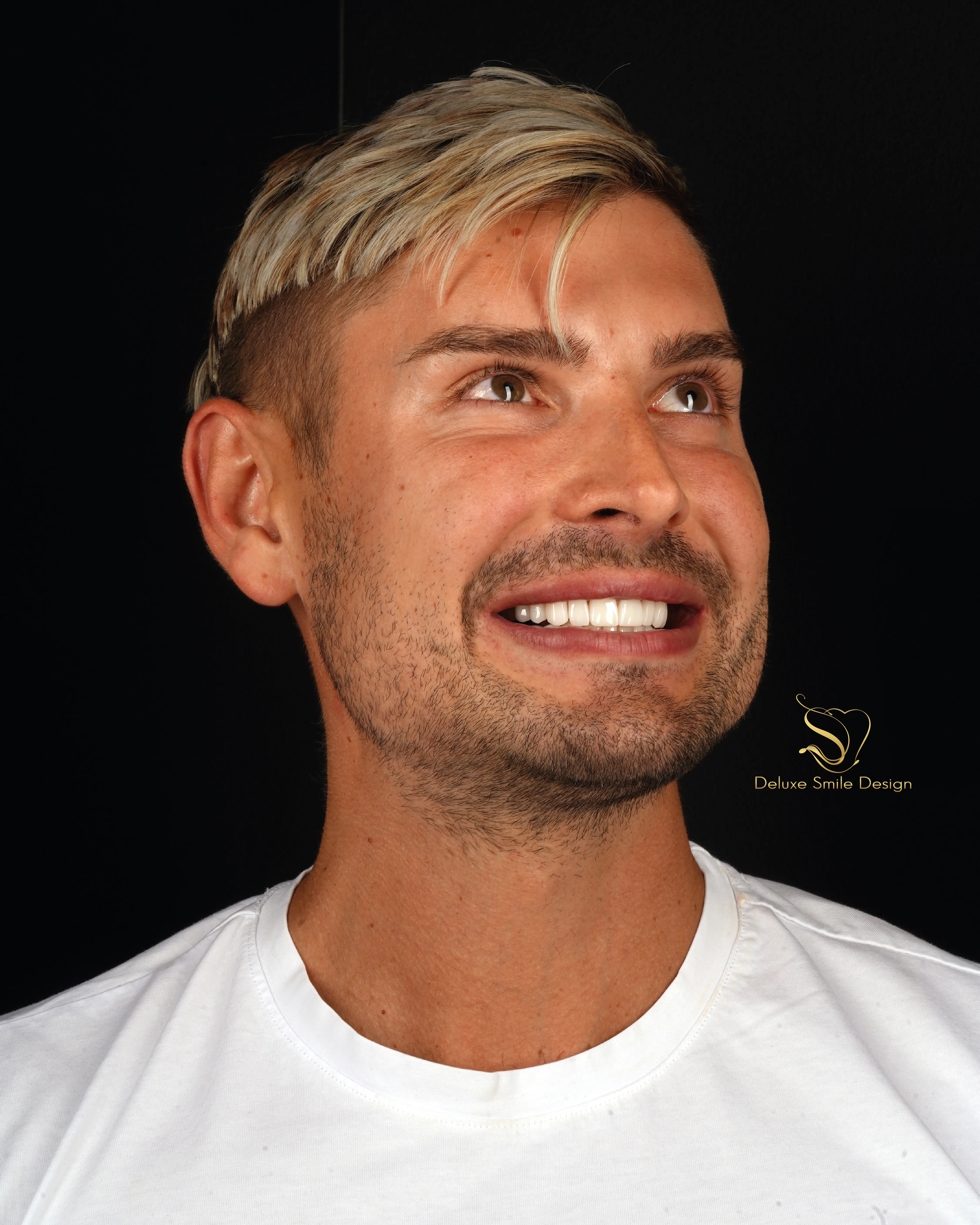 Deluxe Smile|Dental Implant Miami