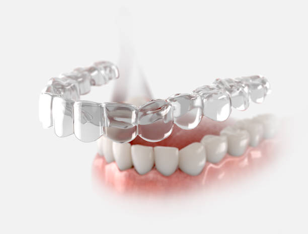 Invisalign