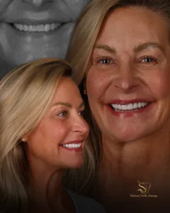 Smile Makeover