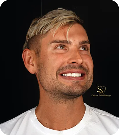 Deluxe Smile|Landing – Dr.plaza