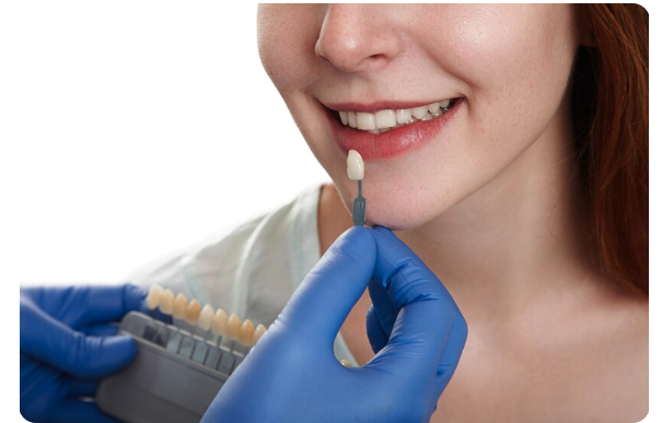 Deluxe Smile | Transform Your Smile: The Art of Porcelain Veneers
