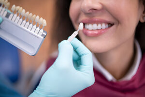 A dentist matches a patient's tooth color using a shade guide.