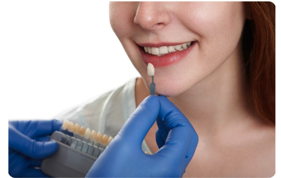 Dentist matches a tooth shade to a smiling woman wearing blue gloves in a dental clinic.