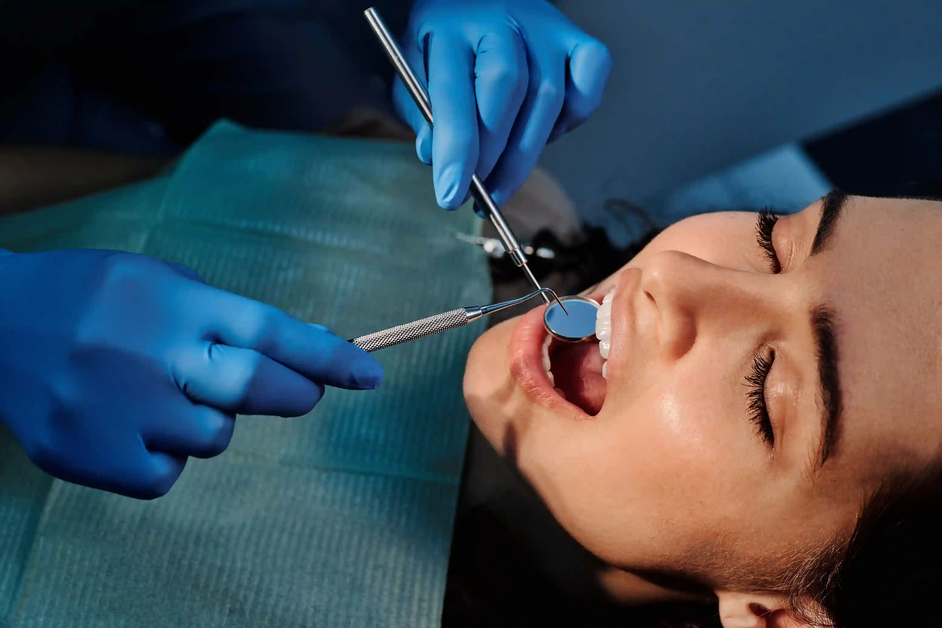 Deluxe Smile | Need Teeth Removal? Here’s Everything Dentists Want You to Know wisdom tooth extraction
