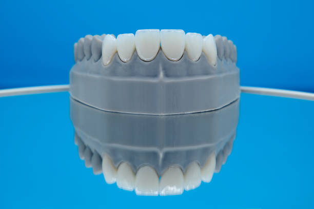 Veneer teeth model produced for premium dental clinics